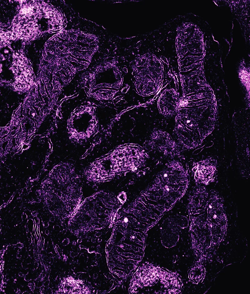 An electron micrograph of a single cell containing dozens of mitochondria, each lined with folded inner membranes, glowing magenta on black