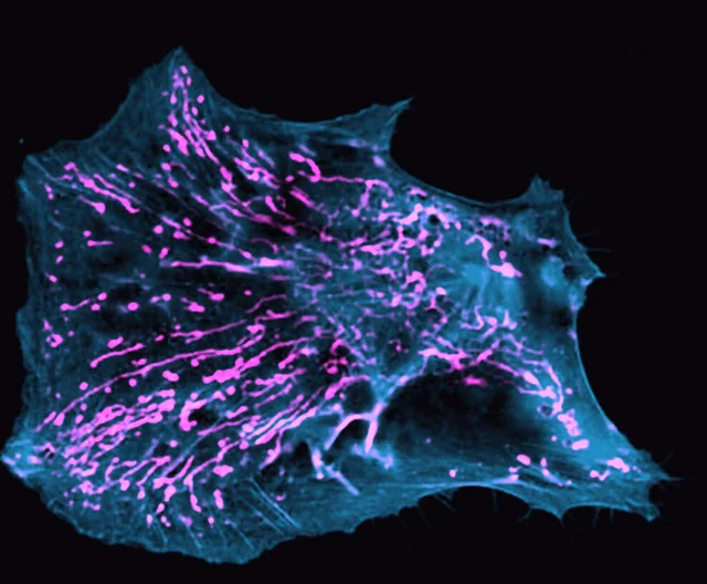 A single primary human fibroblast, its thread-like mitochondria glowing magenta across a teal cytoskeleton
