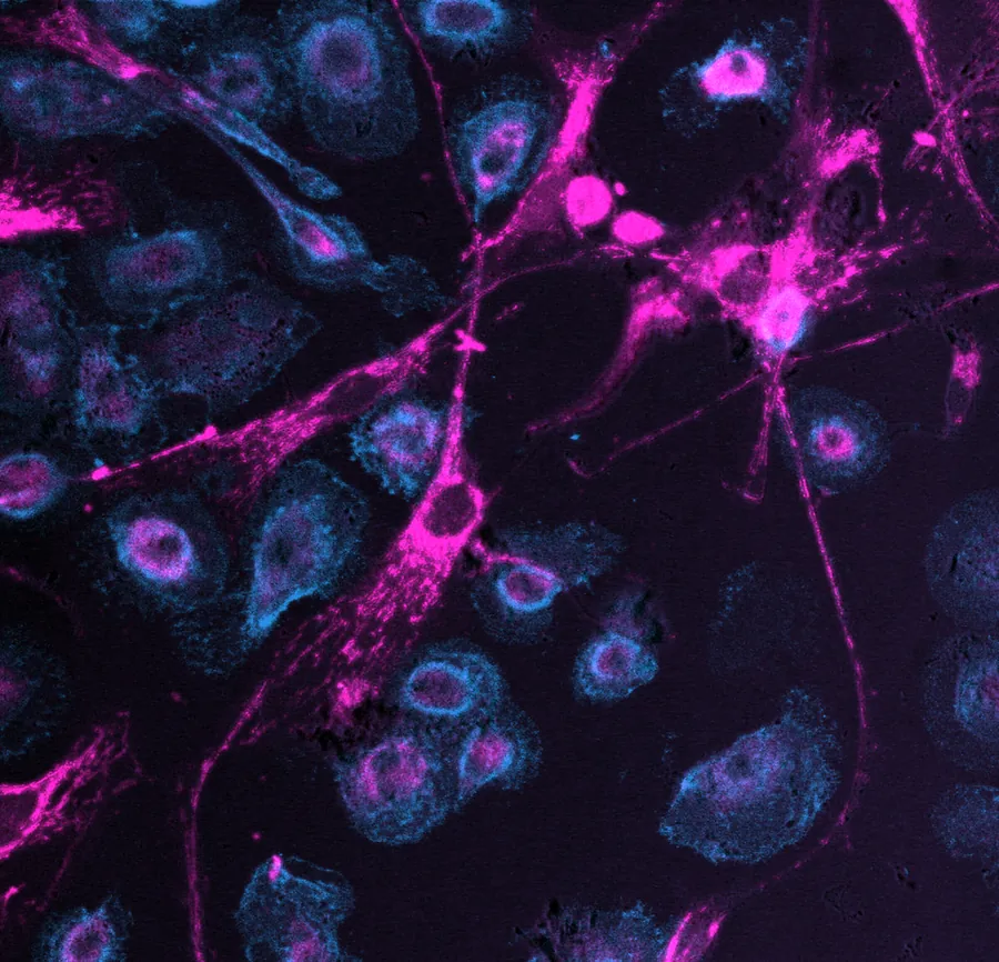 Fluorescence micrograph of human stem cells extending magenta, mitochondria-filled strands towards neighbouring teal immune cells